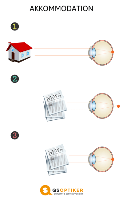 Akkommodation des Auges