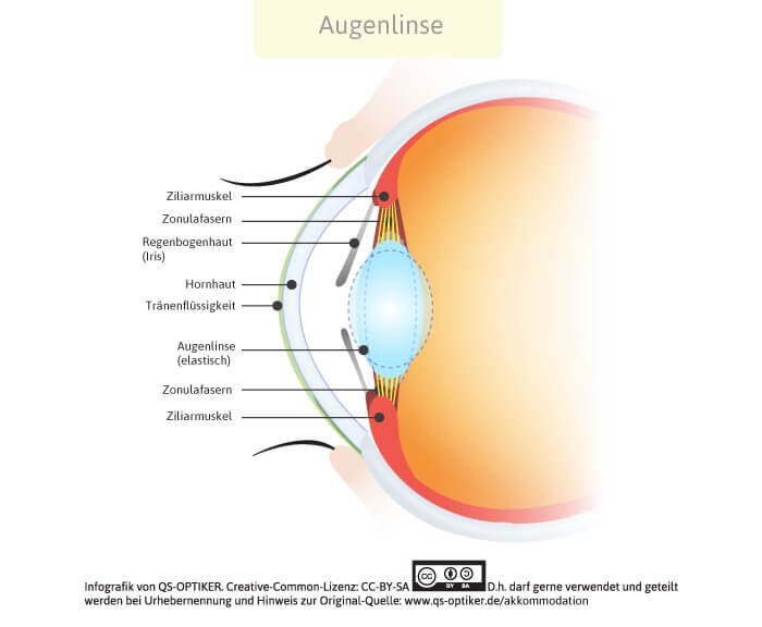 Akkommodation Augenlinse