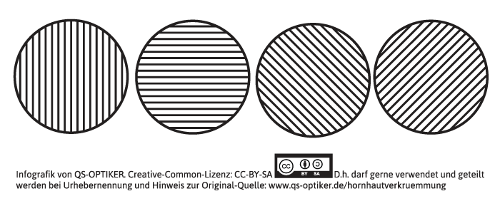 Hornhautverkrümmung Sehtest - Strichkreichtest