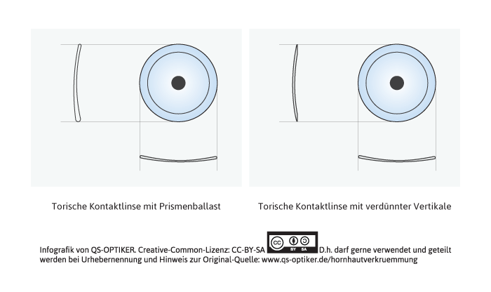 Hornhautverkrummung Astigmatismus Qs Optiker