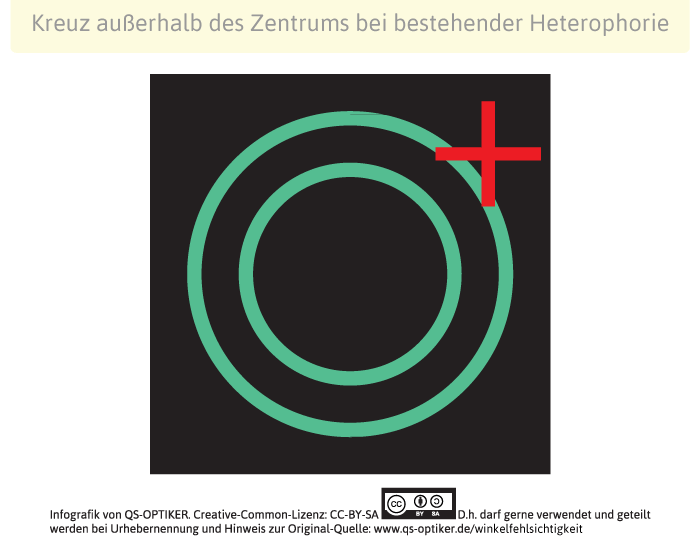 Schober-Test bei Heterophorie