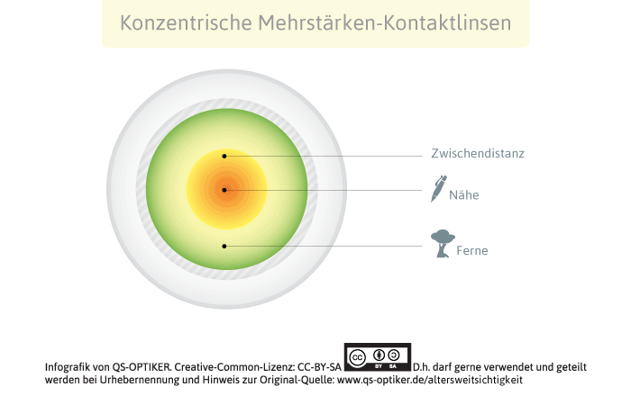 Mehrstärken-Kontaktlinse zur Korrektur der Altersweitsichtigkeit